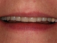 Konig Center for Cosmetic & Comprehensive Dentistry smile photos
